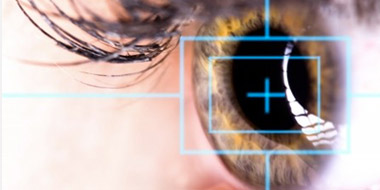 Opération laser des yeux risques - Vos questions