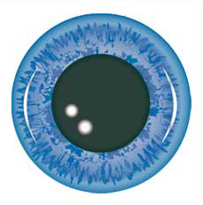 chirurgie astigmatisme, lasik