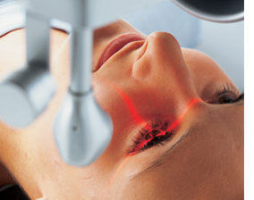 laser excimer, traitement yeux laser